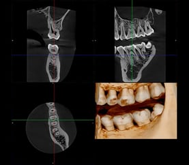 VISO-G1-PLANMECA-SOFTWARE