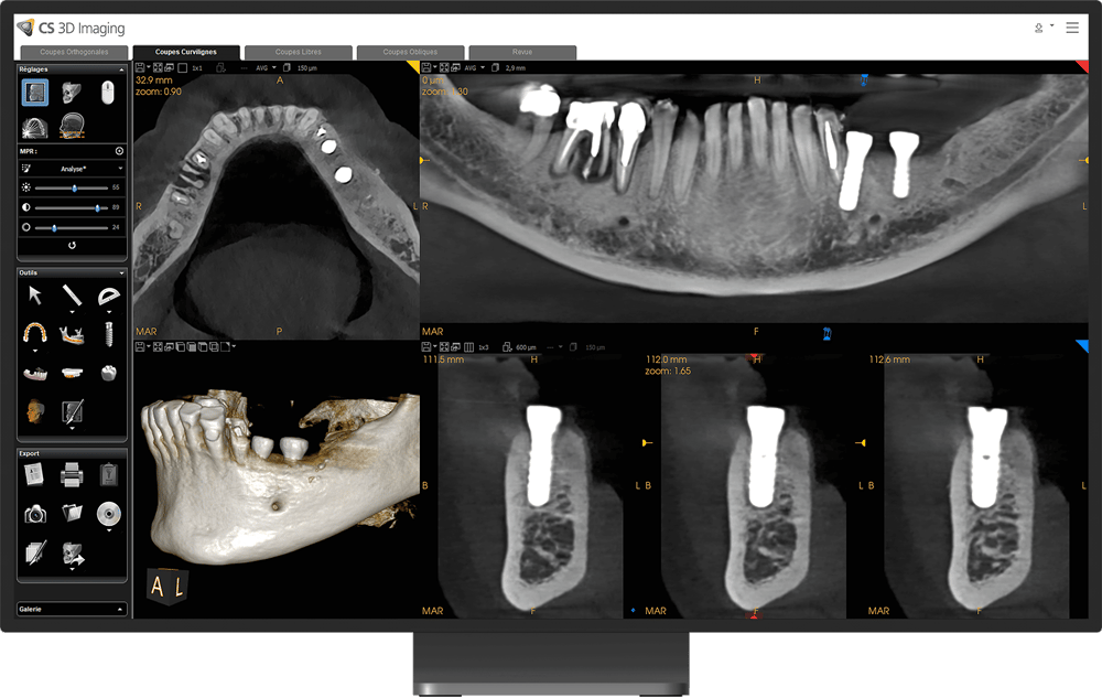 cs-8200-advance-edition-(4)