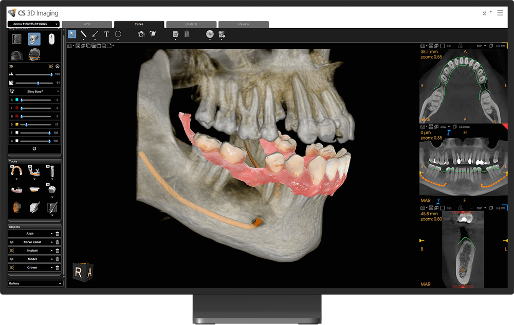 cs-8200-advance-edition-(5)