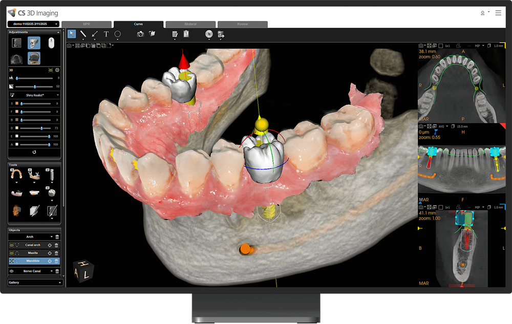 cs-8200-advance-edition-(7)