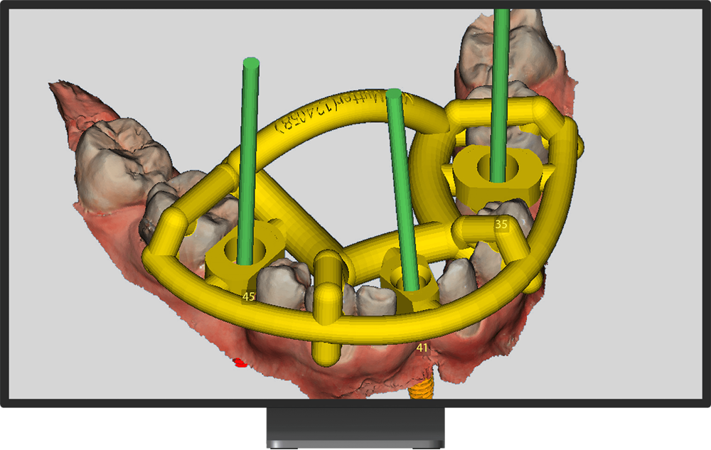 cs-8200-advance-edition-(9)