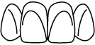 smile-design