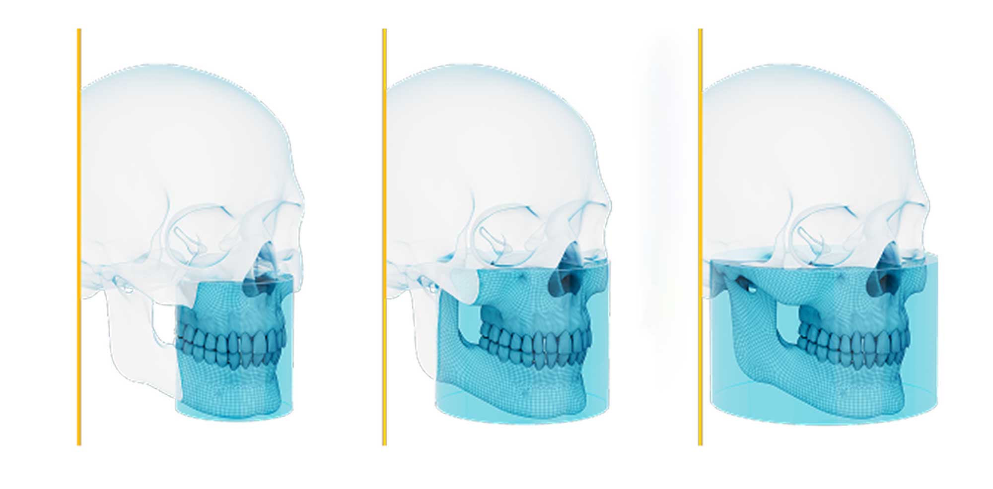 Campos-de-visión-CS8200