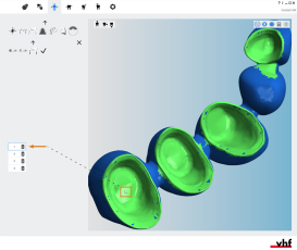 dentalcam-software-cavidades dentalcam-software-cavidades